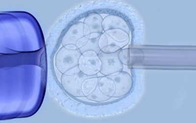 Accuracy of preimplantation genetic screening (PGS)