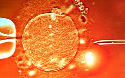 How is ICSI different from IVF?