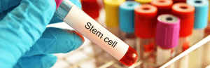 explain about stem cell therapy pain