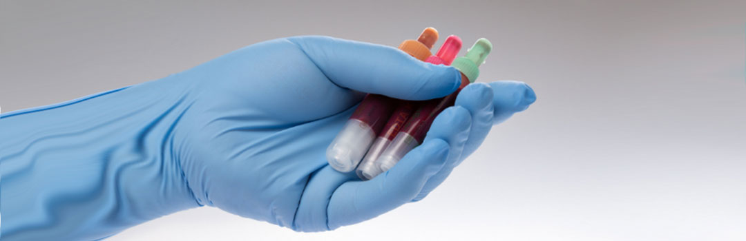 Why is the AMH test important before IVF?