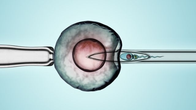 All AboutIntracytoplasmic morphologically selected sperm injection (IMSI) | Shree IVF Clinic - Dr. Jay Mehta