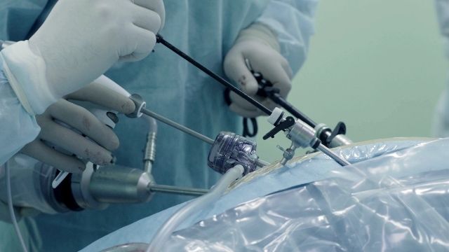 laparoscopic hysterectomy before and after