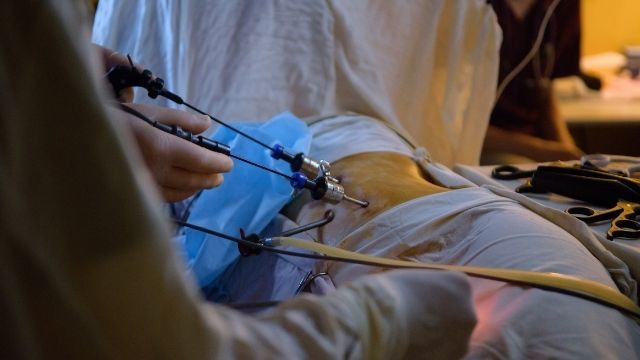 laparoscopic-surgery All About Laparoscopic Surgery | Shree IVF Clinic - Dr. Jay Mehta
