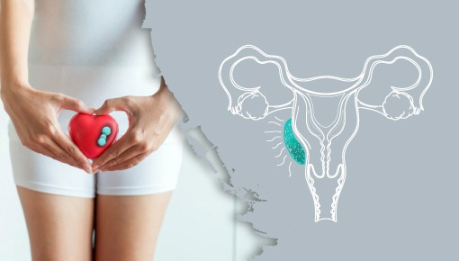 Stage 4 Vulvar Cancer: Definition, Treatment, and Survival Rates