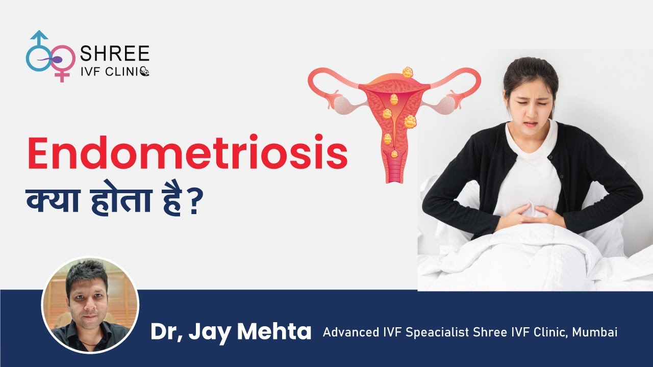 What Exactly is Endometriosis?