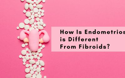 how-is-endometriosis-different-from-fibroids