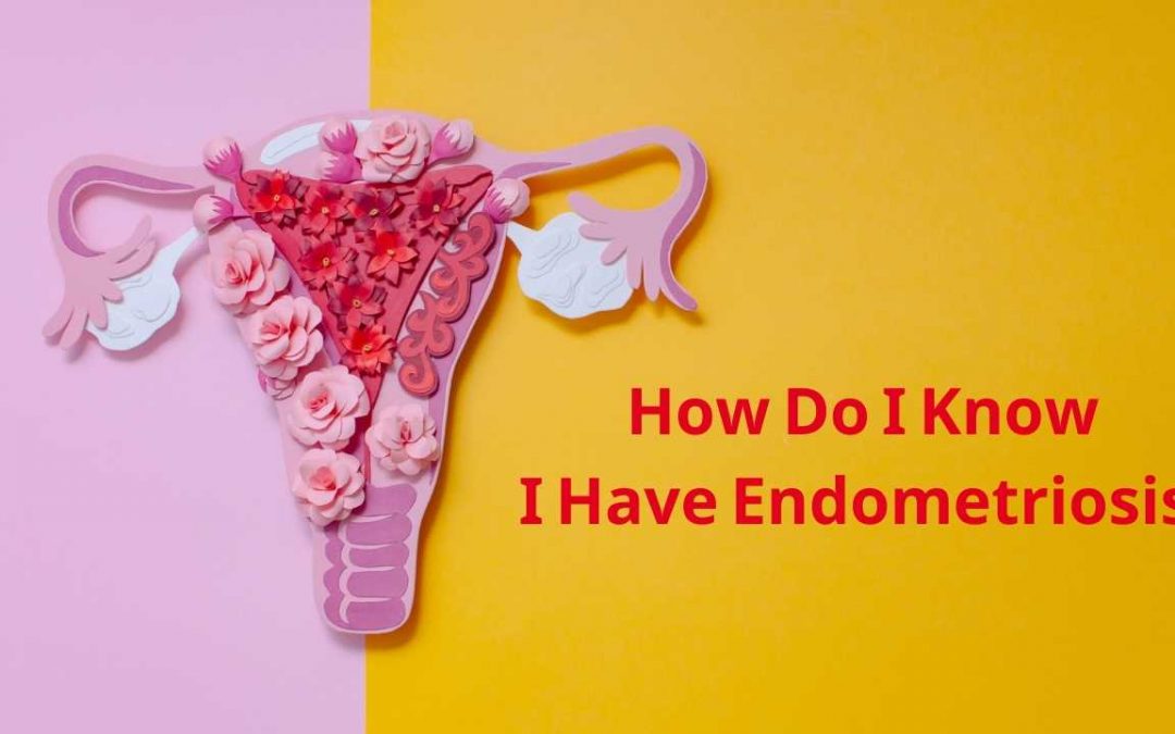 How Do I Know I Have Endometriosis?