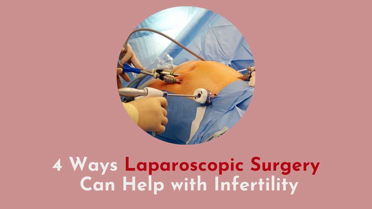 4 Ways Laparoscopic Surgery Can Help with Infertility