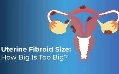uterine-fibroid-size