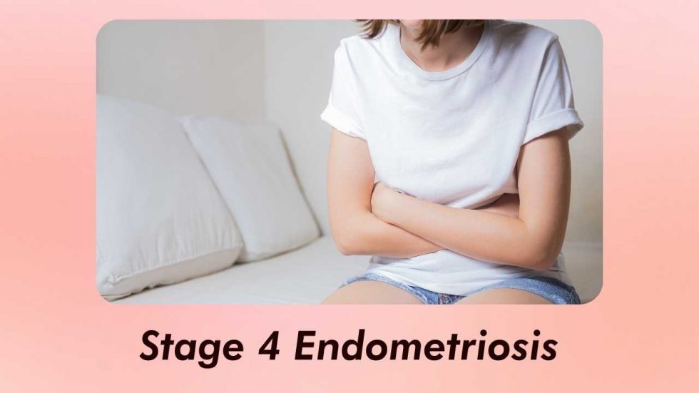 Endometriosis Stage 4 Sign, Curable and Treatment