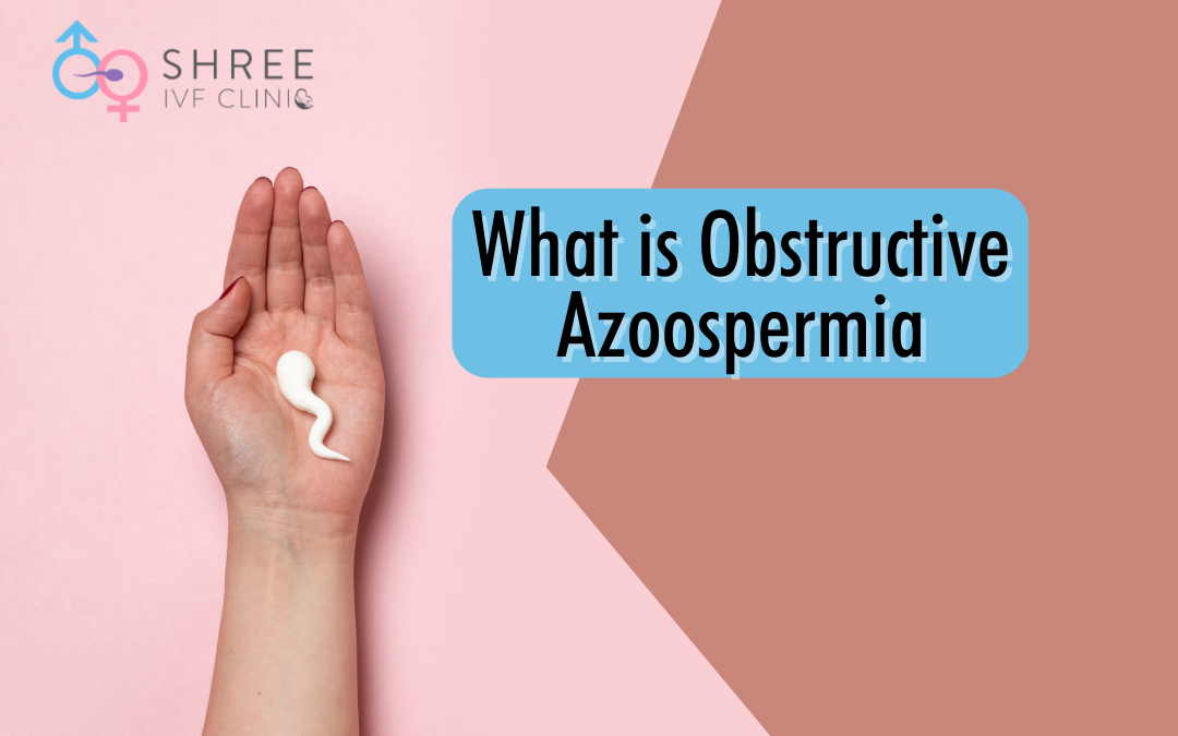 Patient’s complete guide to Obstructive Azoospermia