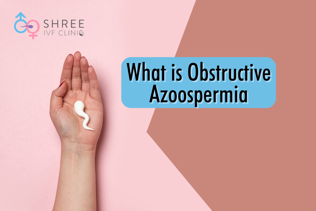 Patient’s complete guide to Obstructive Azoospermia