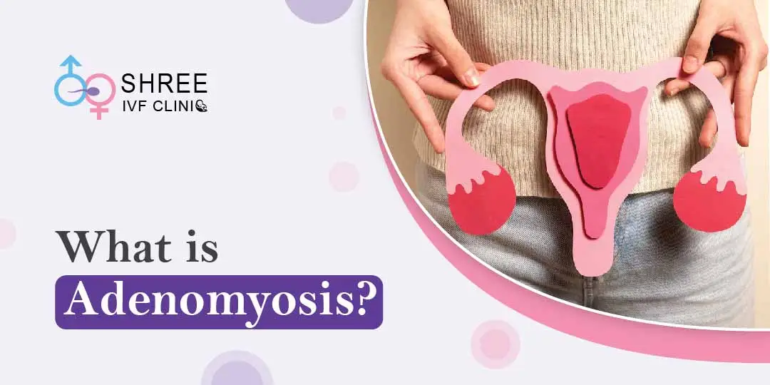 What is the meaning of Adenomyosis?