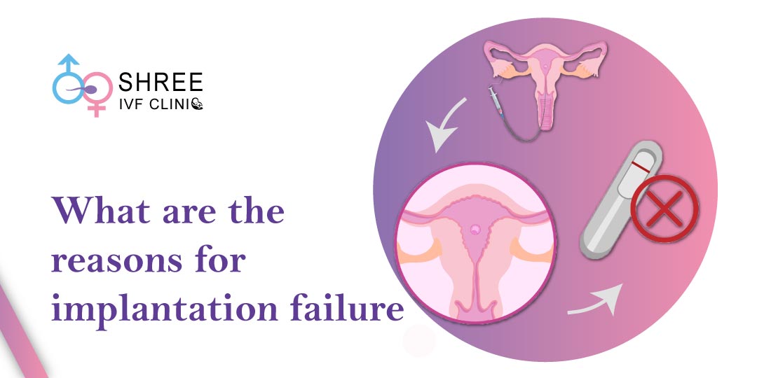 Understanding the Main Reasons for Implantation Failure?