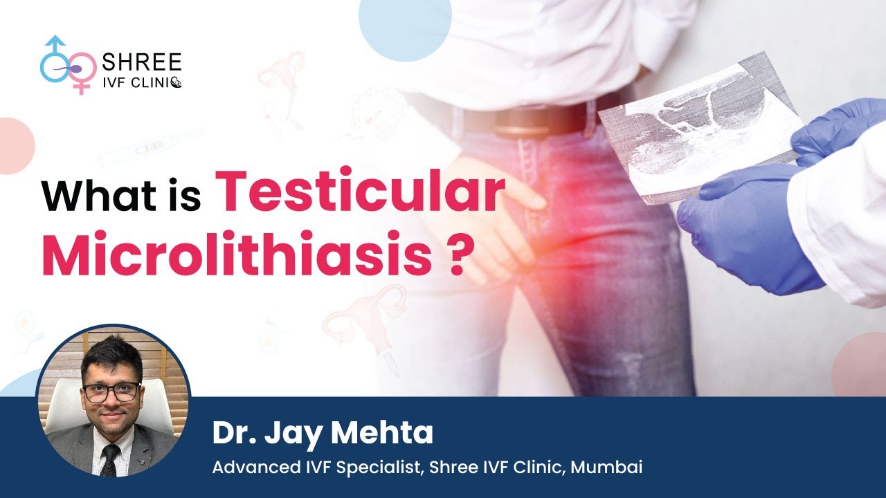 Understanding Testicular Microlithiasis