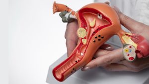 Ovarian Rejuvination