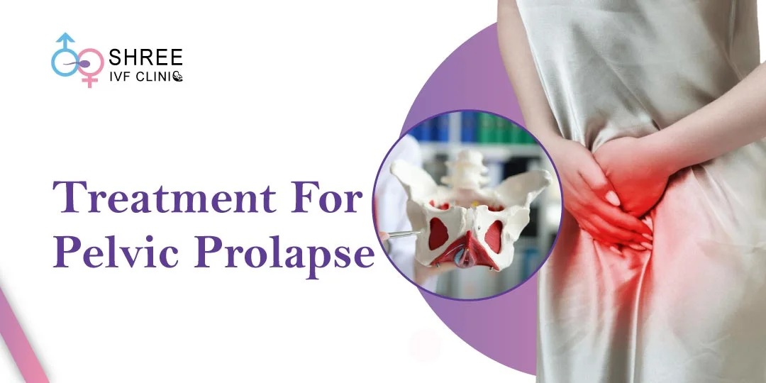Treatment for Pelvic Prolapse