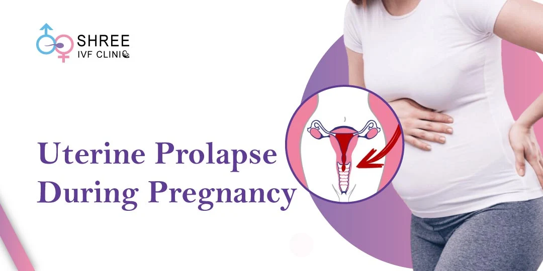 Uterine Prolapse During Pregnancy: Risks, Symptoms & Care