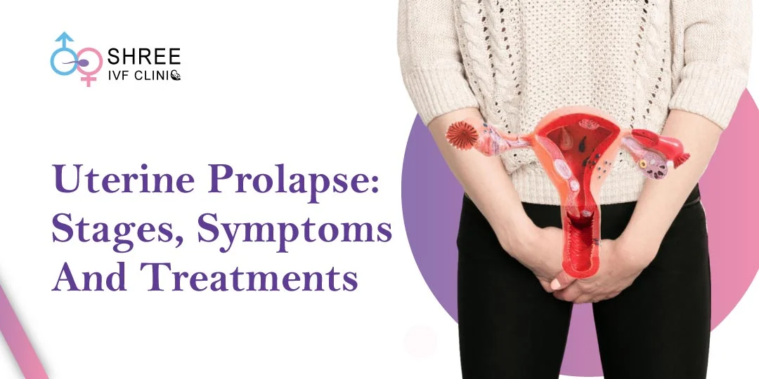 Understanding Uterine Prolapse: Stages, Symptoms, and Treatments