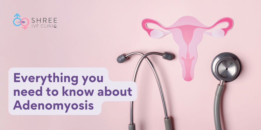 What Causes Adenomyosis? Guide to Causes, Diagnosis & Treatments Available