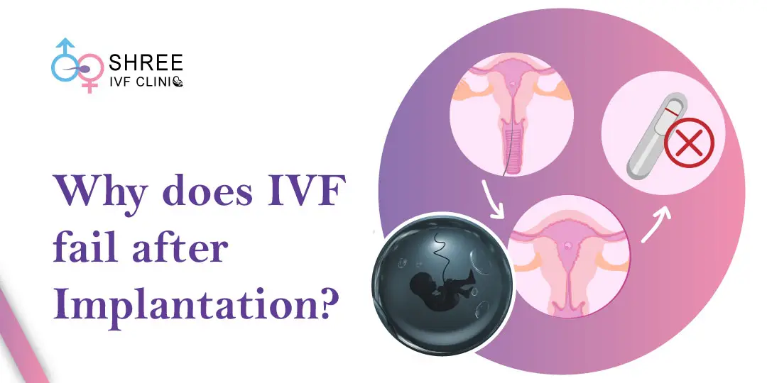 Can IVF Fail After Successful Implantation?