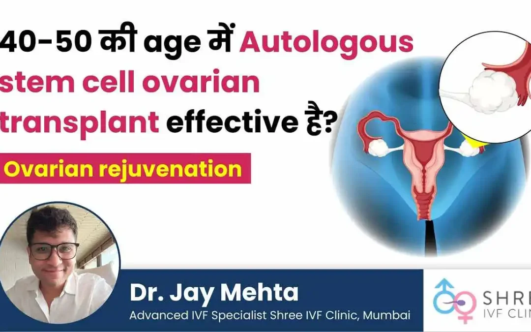 Ovarian Stem Cell Transplant (Age 40-50): Does It Work?