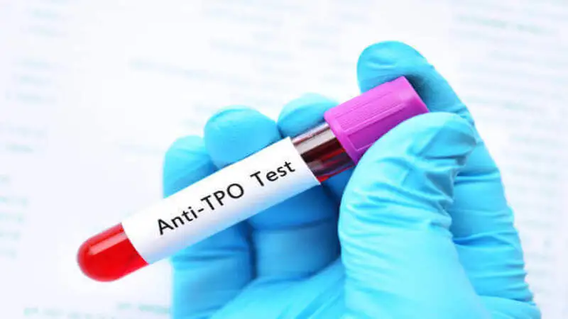 anti-TPO antibody test