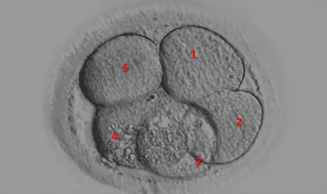 Embryo fragmentation in IVF