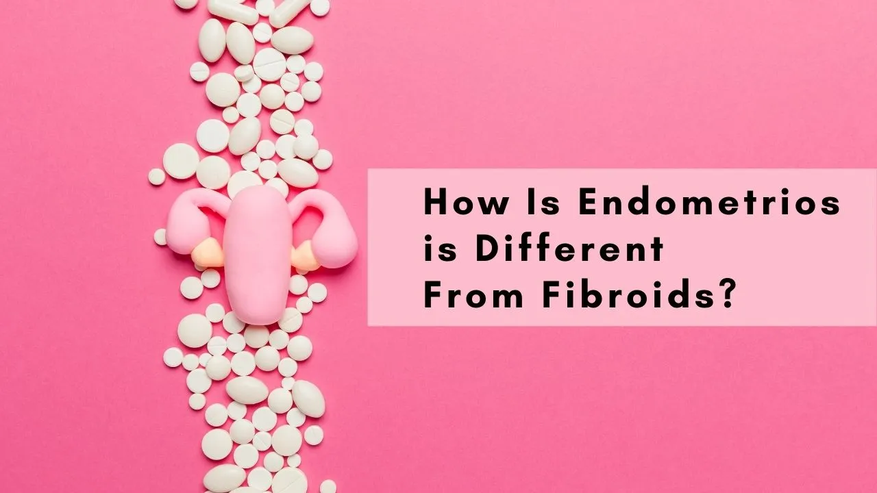 How Is Endometriosis Different From Fibroids?