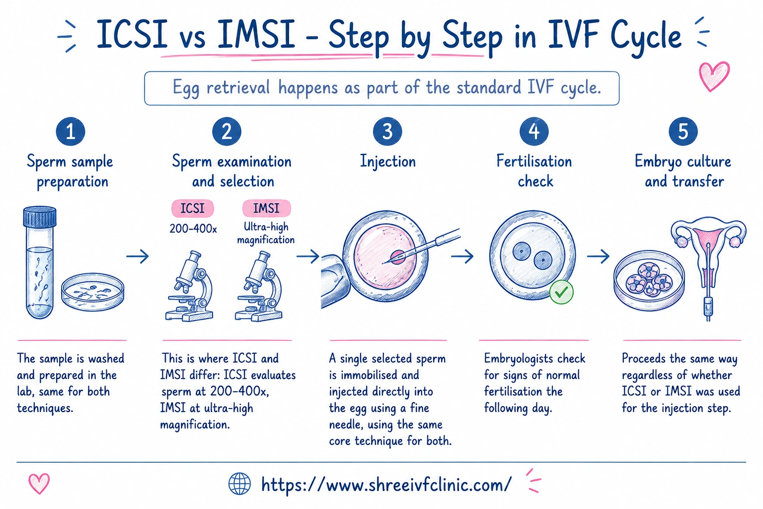 ICSI and IMSI ICSI and IMSI
