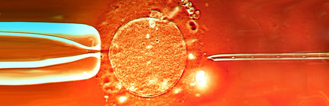 How is ICSI different from IVF?