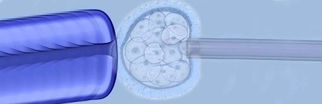 How Accurate is Preimplantation Genetic Screening?