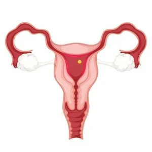 anatomy-of-a-uterus anatomy-of-a-uterus