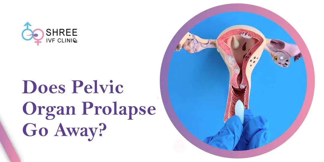 Does pelvic organ prolapse go away Treatment for Pelvic Prolapse