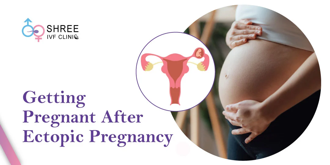 Getting Pregnant After Ectopic Pregnancy