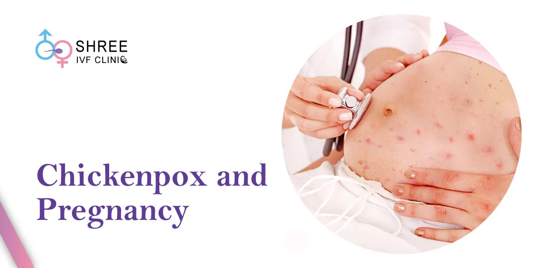 Chickenpox and Pregnancy